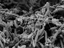 M. tuberculosis